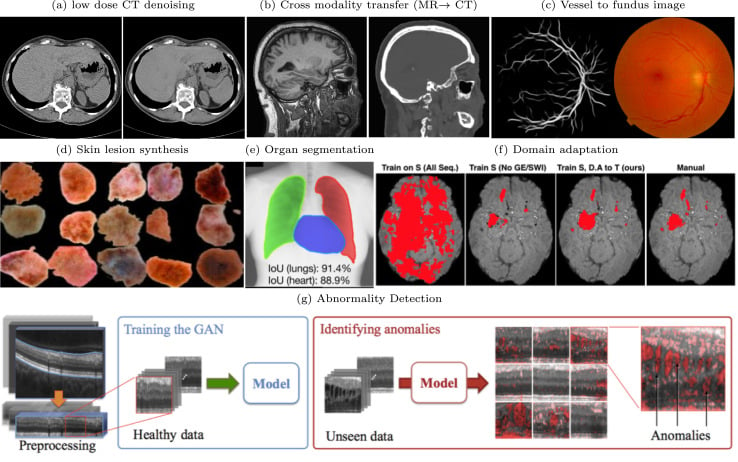 Top Generative AI Use Cases In The Healthcare Industry